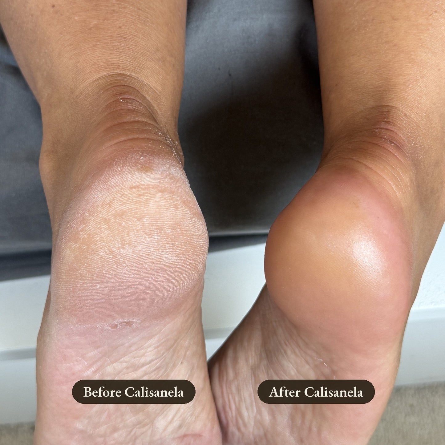 Calisanela Foot Smoother