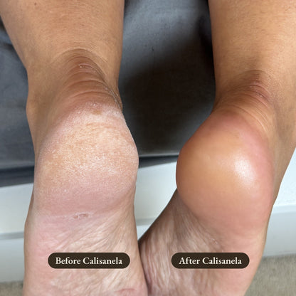 Calisanela Foot Smoother